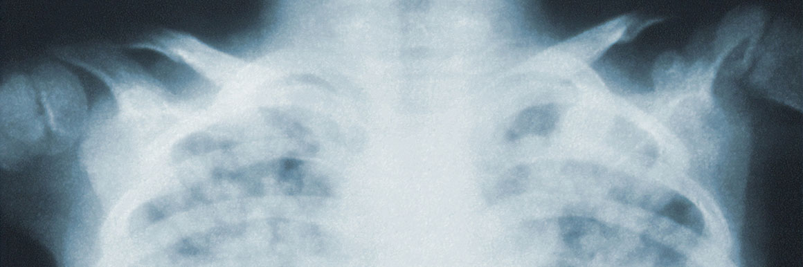KI Röntgenaufnahmen ETECTURE