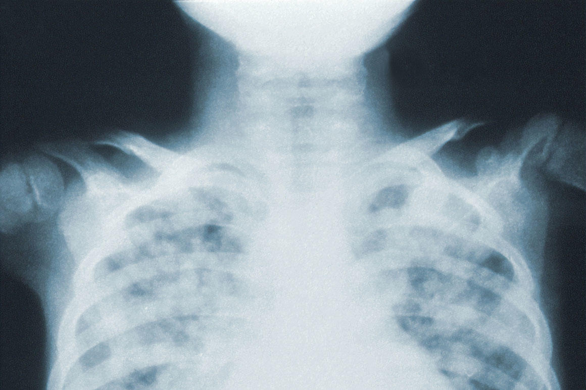 KI Röntgenaufnahmen ETECTURE